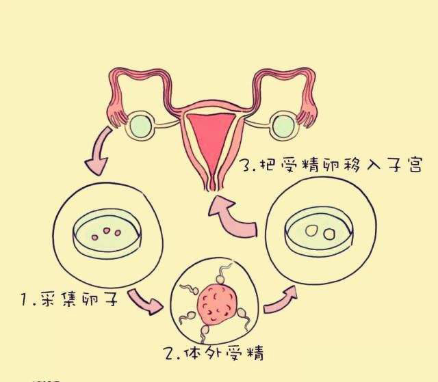 第二代试管婴儿大概费用-黑龙江省多囊卵巢试管