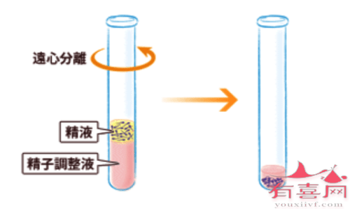 合肥供卵试管生子-前列腺肥大的人可以做试管婴